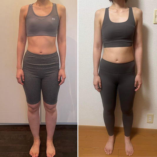 体重が減っても変化なし! 20年前から下半身のむくみに悩んでいました!