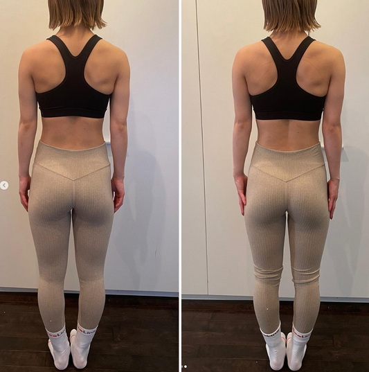 アスリートも浮腫んでいる! Part 1: むくみケアで筋肉がよみがえる!