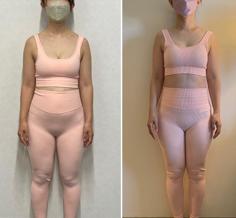 新しいビューティートレンド:「むくみケア」でむくみ解消!