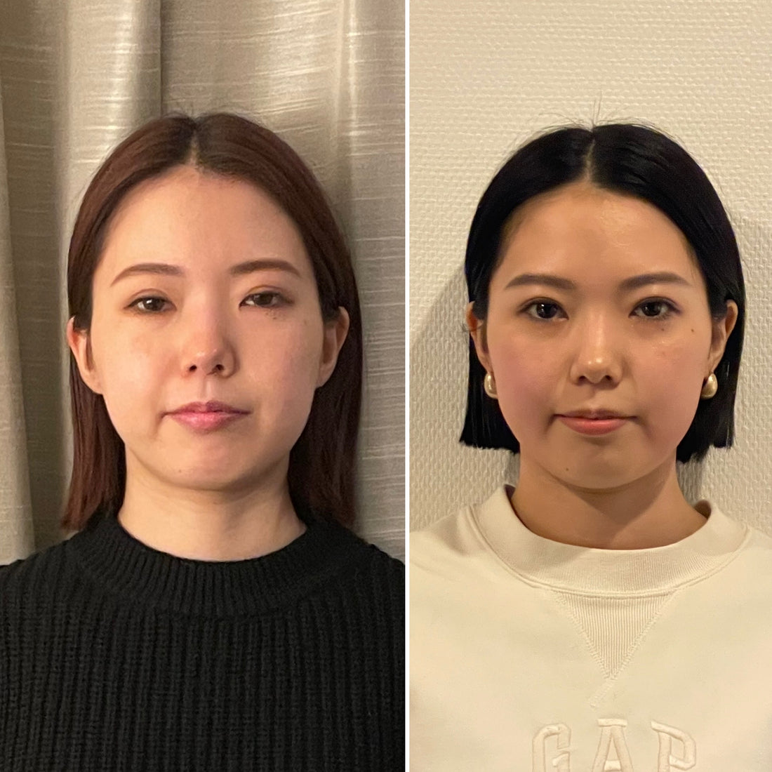 頭頚部むくみケア モニター募集中