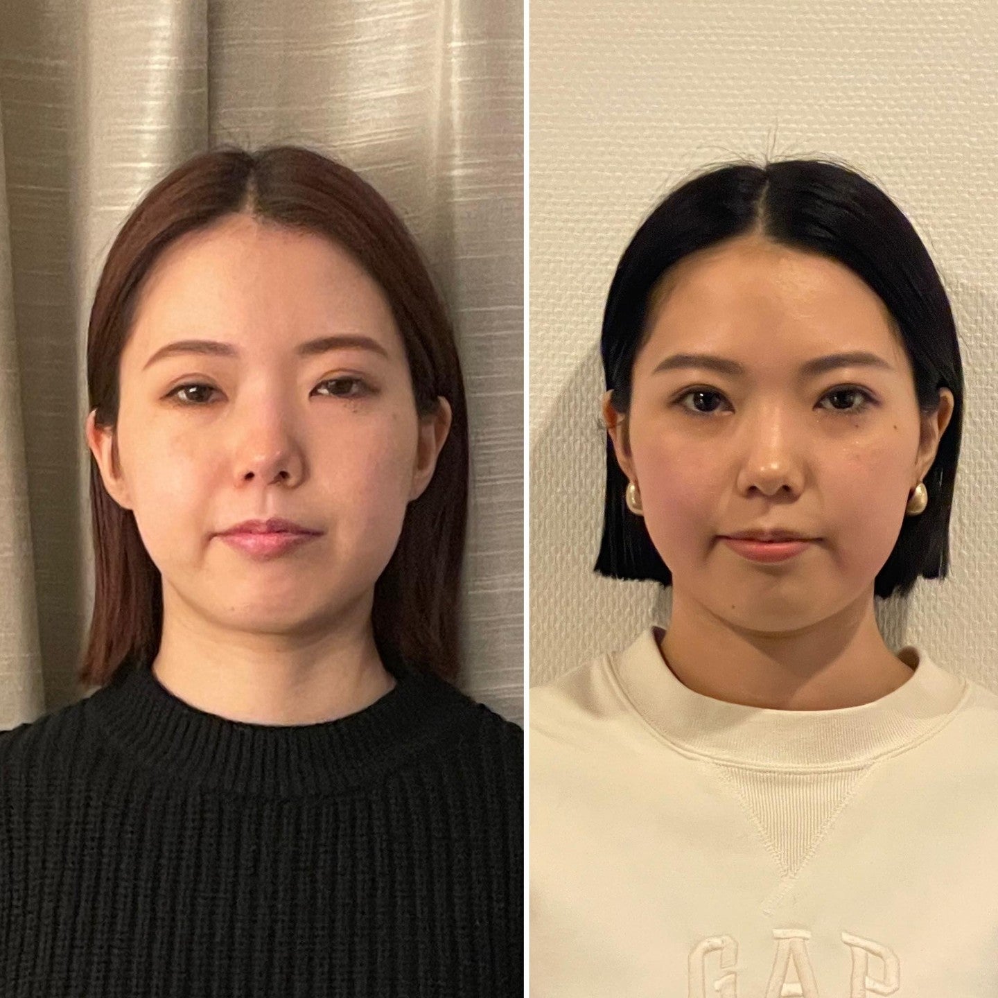 フェイシャルむくみケア(1時間)