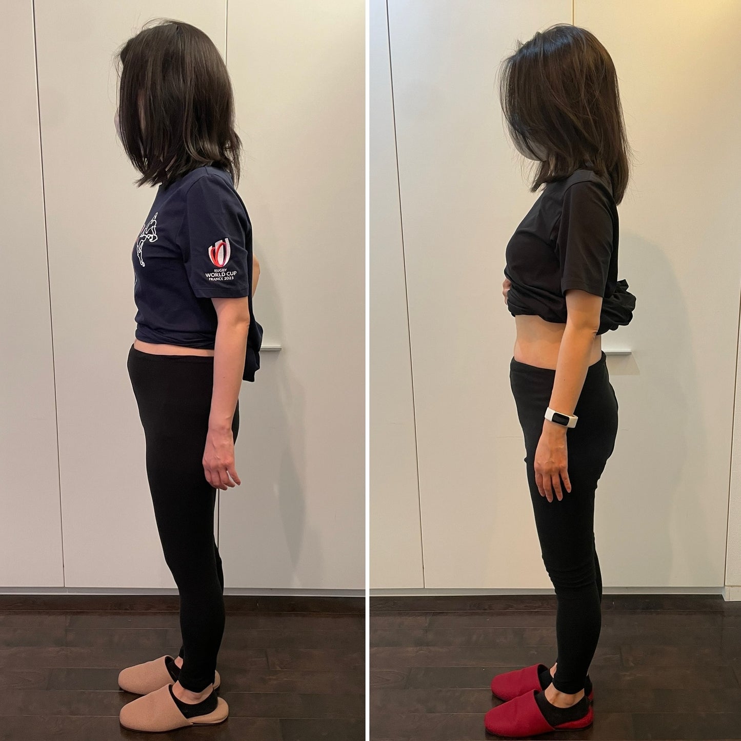 Local Edema Care (1 hour)